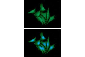 anti-Hypoxanthine phosphoribosyltransferase 1 (HPRT1) (AA 1-218) antibody