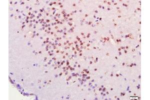 Paraformaldehyde-fixed, paraffin embedded Mouse brain, Antigen retrieval by boiling in sodium citrate buffer (pH6. (FOXJ1 抗体  (AA 161-260))