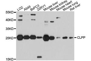 Western blot analysis of extracts of various cells, using CLPP antibody. (CLPP 抗体)