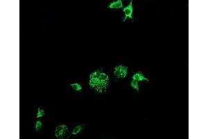 Image no. 3 for anti-Cytidine Monophosphate (UMP-CMP) Kinase 1, Cytosolic (CMPK1) antibody (ABIN1497544) (Cytidine Monophosphate (UMP-CMP) Kinase 1, Cytosolic (CMPK1) 抗体)