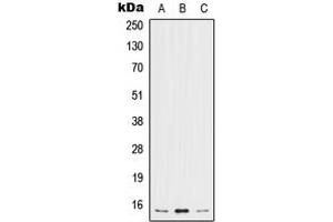 Western blot analysis of IL-5 expression in MCF7 (A), SP2/0 (B), H9C2 (C) whole cell lysates. (IL-5 抗体  (Center))