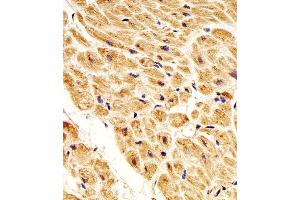 Immunohistochemical analysis of paraffin-embedded H. (NME1 抗体)