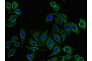 Immunofluorescent analysis of A549 cells using ABIN7168038 at dilution of 1:100 and Alexa Fluor 488-congugated AffiniPure Goat Anti-Rabbit IgG(H+L) (RHOH 抗体  (AA 1-188))