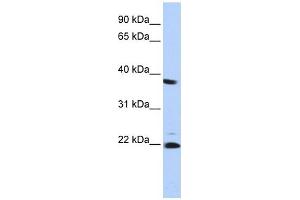 PSMB2 antibody used at 1 ug/ml to detect target protein. (PSMB2 抗体)