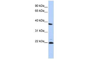 PSMB2 antibody used at 1 ug/ml to detect target protein.