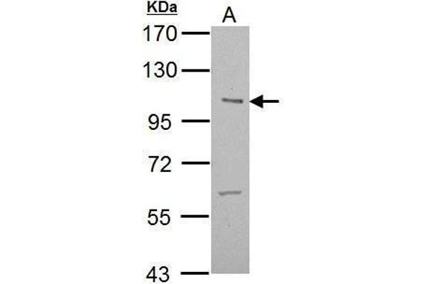 ULK2 抗体  (C-Term)