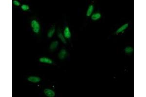Image no. 4 for anti-Cyclin-Dependent Kinase 2 (CDK2) antibody (ABIN1497394) (CDK2 抗体)