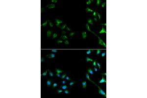 Immunofluorescence analysis of A549 cell using ERK1/2 antibody. (ERK2 抗体  (AA 200-300))