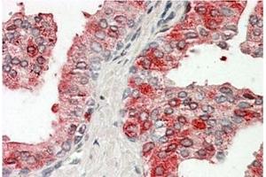 AP20162PU-N ACPP Antibody staining of paraffin embedded Human Prostate at 3. (ACPP 抗体  (Internal Region))