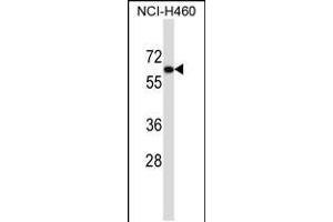 Western blot analysis in NCI-H460 cell line lysates (35ug/lane). (UGT2B11 抗体  (C-Term))