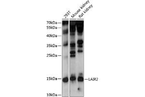 Western blot analysis of extracts of various cell lines, using L antibody  at 1:1000 dilution. (LAIR2 抗体  (AA 22-120))