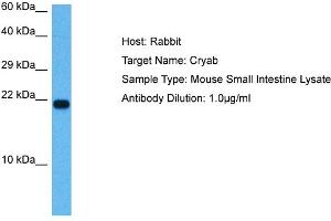 Host: Mouse Target Name: CRYAB Sample Tissue: Mouse Small Intestine Antibody Dilution: 1ug/ml (CRYAB 抗体  (N-Term))