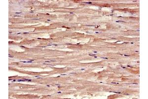 Immunohistochemistry of paraffin-embedded human skeletal muscle tissue using ABIN7171205 at dilution of 1:100 (SYNM 抗体  (AA 1147-1417))