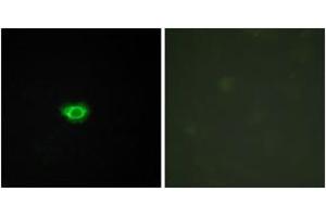 Immunofluorescence analysis of HuvEc cells, using GPR108 Antibody. (GPR108 抗体  (AA 155-204))