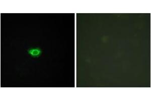 Immunofluorescence analysis of HuvEc cells, using GPR108 Antibody. (GPR108 抗体  (AA 155-204))