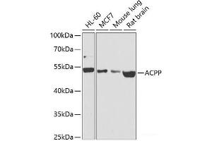 Western blot analysis of extracts of various cell lines using ACPP Polyclonal Antibody at dilution of 1:1000. (ACPP 抗体)
