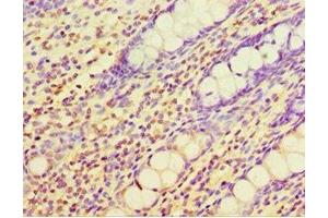 Immunohistochemistry of paraffin-embedded human colon tissue using ABIN7147558 at dilution of 1:100 (CHI3L2 抗体  (AA 27-390))