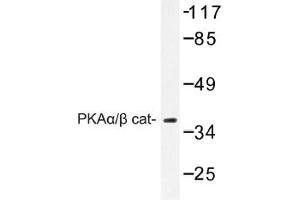 Image no. 1 for anti-Protein Kinase A, alpha (PRKACA) antibody (ABIN317665) (PRKACA 抗体)
