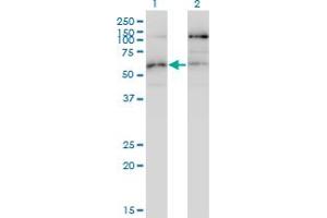 Western Blot analysis of STK38L expression in transfected 293T cell line by STK38L monoclonal antibody (M01), clone 4E5.