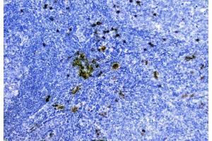 IHC analysis of Hemoglobin using anti-Hemoglobin antibody (ABIN5518839). (HBA1 抗体  (AA 2-142))