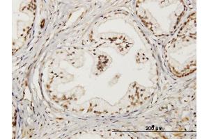 Immunoperoxidase of monoclonal antibody to LMO4 on formalin-fixed paraffin-embedded human prostate. (LMO4 抗体  (AA 1-165))