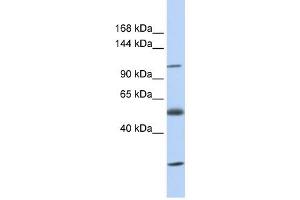 SLC39A10 antibody used at 1 ug/ml to detect target protein. (SLC39A10 抗体)