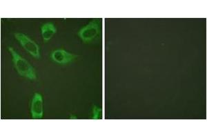 Immunofluorescence analysis of HeLa cells, using S6 Ribosomal Protein (Phospho-Ser240) Antibody.