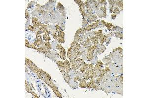 Immunohistochemistry (IHC) image for anti-Heat Shock 22kDa Protein 8 (HSPB8) (AA 1-196) antibody (ABIN3016167)