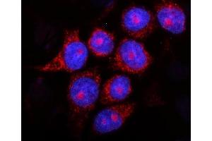 IF analysis of Presenilin 2/AD5/PSEN2 using anti-Presenilin 2/AD5/PSEN2 antibody (ABIN7602796). (Presenilin 2 抗体  (C-Term))