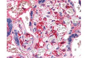 Anti-PF4 antibody IHC of human placenta. (PF4 抗体)