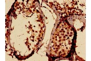 Immunohistochemistry analysis of human testis tissue using ABIN7169803 at dilution of 1:100 (SLITRK5 抗体  (AA 617-890))