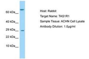 Image no. 1 for anti-Taste Receptor, Type 1, Member 1 (TAS1R1) (AA 327-376) antibody (ABIN6750003) (TAS1R1 抗体  (AA 327-376))