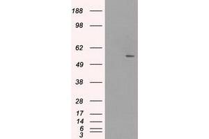 Image no. 1 for anti-Solute Carrier Family 2 (Facilitated Glucose/fructose Transporter), Member 5 (SLC2A5) antibody (ABIN1498474) (SLC2A5 抗体)