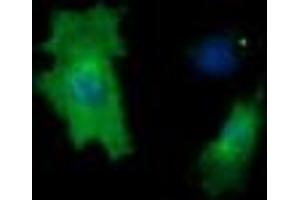 Image no. 4 for anti-Cancer/testis Antigen 1B (CTAG1B) antibody (ABIN1499892) (CTAG1B 抗体)