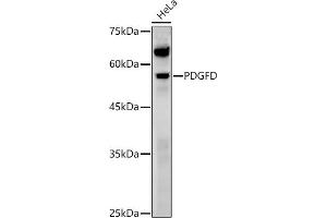 Western blot analysis of extracts of various cell lines, using PDGFD antibody (ABIN7269393) at 1:1000 dilution. (PDGFD 抗体  (AA 185-364))