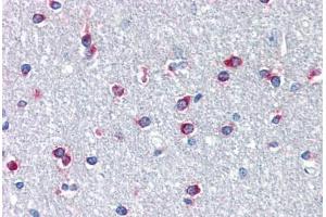Image no. 1 for anti-Pituitary Homeobox 3 (PITX3) (N-Term) antibody (ABIN1495362) (PITX3 抗体  (N-Term))