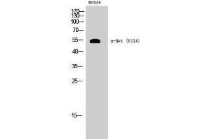 Western Blotting (WB) image for anti-V-Akt Murine Thymoma Viral Oncogene Homolog 1 (AKT1) (pSer124) antibody (ABIN3182507) (AKT1 抗体  (pSer124))