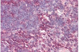 Image no. 2 for anti-Lamin B Receptor (LBR) (AA 503-552) antibody (ABIN6749731) (Lamin B Receptor 抗体  (AA 503-552))