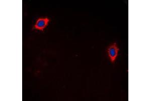 Immunofluorescent analysis of GHRH Receptor staining in LOVO cells. (GHRHR 抗体  (C-Term))