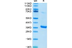 Human HMGB1 on Tris-Bis PAGE under reduced condition. (HMGB1 Protein (AA 1-215) (His tag))