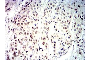 Immunohistochemistry (IHC) image for anti-Caudal Type Homeobox 2 (CDX2) (AA 1-180) antibody (ABIN7193689)