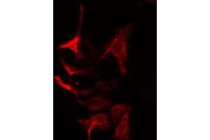 ABIN6275023 staining Hela cells by IF/ICC. (COPZ1 抗体  (N-Term))