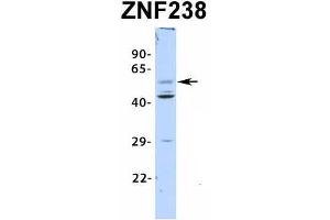 Host:  Rabbit  Target Name:  ZNF238  Sample Type:  Human Fetal Pancreas  Antibody Dilution:  1. (ZNF238 抗体  (N-Term))