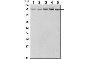 Western blot analysis using STAT3 mouse mAb against Hela (1),NIH/3T3 (2), Jurkat (3), PC-12 (4) and COS7 (5) cell lysate.