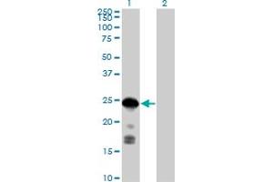Western Blot analysis of CDKN1B expression in transfected 293T cell line by CDKN1B MaxPab polyclonal antibody. (CDKN1B 抗体  (AA 1-198))