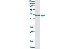 Immunoprecipitation of SPHK1 transfected lysate using anti-SPHK1 monoclonal antibody and Protein A Magnetic Bead , and immunoblotted with SPHK1 MaxPab rabbit polyclonal antibody. (SPHK1 抗体  (AA 1-384))