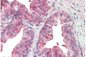Human Prostate: Formalin-Fixed, Paraffin-Embedded (FFPE) (KIF6 抗体  (AA 177-190))