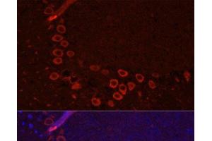Immunofluorescence analysis of Mouse brain using SLC1A1 Polyclonal Antibody at dilution of 1:100. (SLC1A1 抗体)