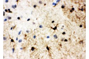 Immunohistochemistry (IHC) image for anti-Heat shock factor protein 2 (HSF2) (AA 82-102), (Middle Region) antibody (ABIN3044217)