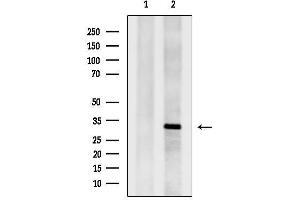 Western blot analysis of lysates from 3, using TPS Antibody.